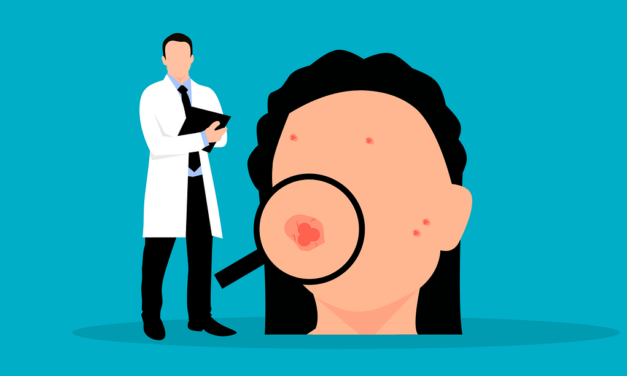 Vier AOKen führen Teledermatologie ein